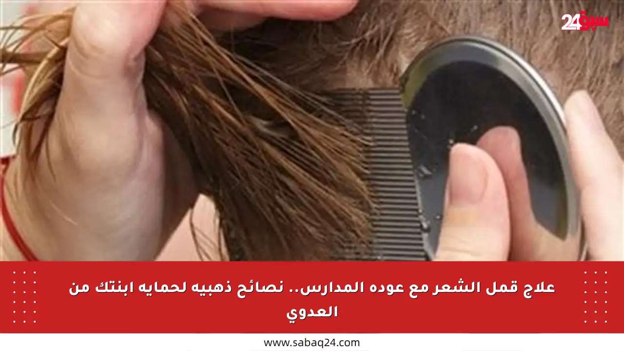 علاج قمل الشعر مع عودة المدارس.. نصائح ذهبية لحماية ابنتك من العدوى